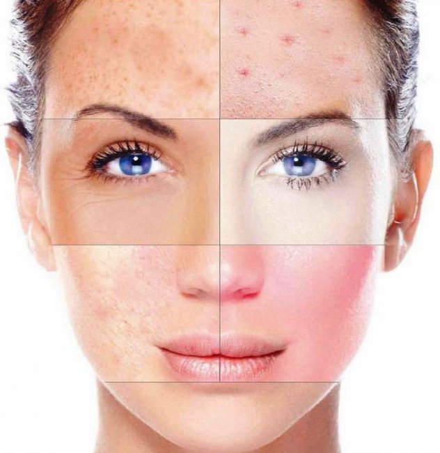 Определяем тип кожи лица