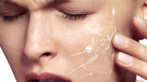 Как восстановить обезвоженную кожу?