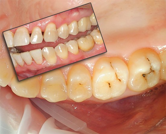 Ужасно болит зуб — сигнал к быстрому действию