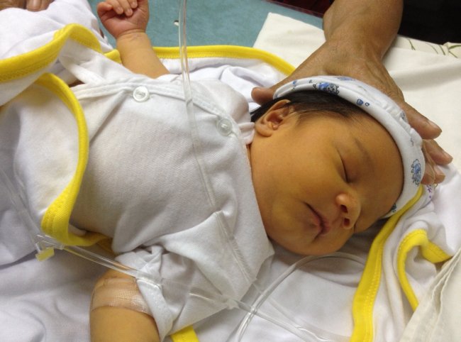 Причины желтушки у новорожденного