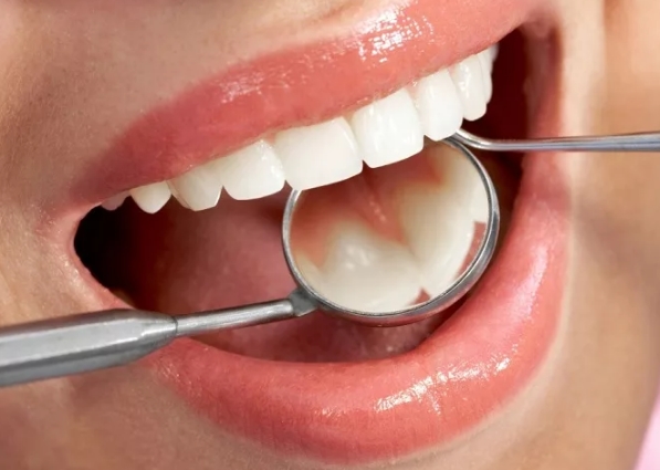 Лечение зубов – современная терапия, позволяющая сделать улыбку здоровой и красивой