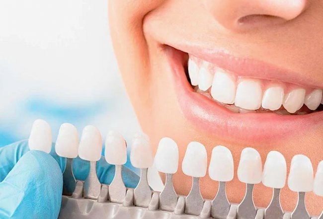 Советы по отбеливанию зубов