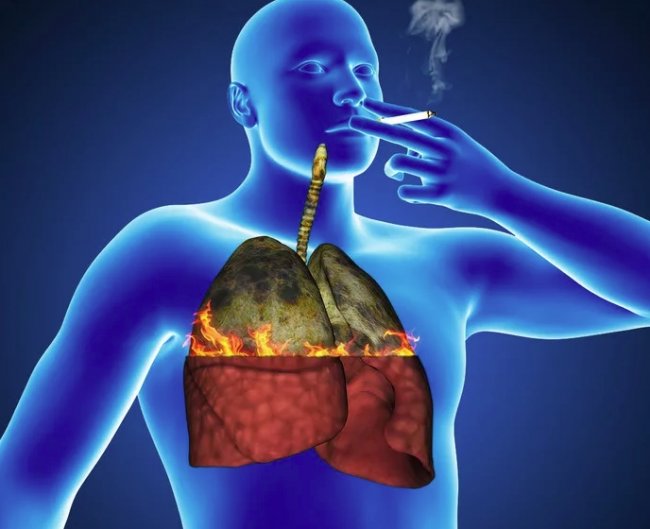 Взаимосвязь курения и заболеваний органов дыхания...
